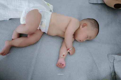 深圳宝宝头上长痱子